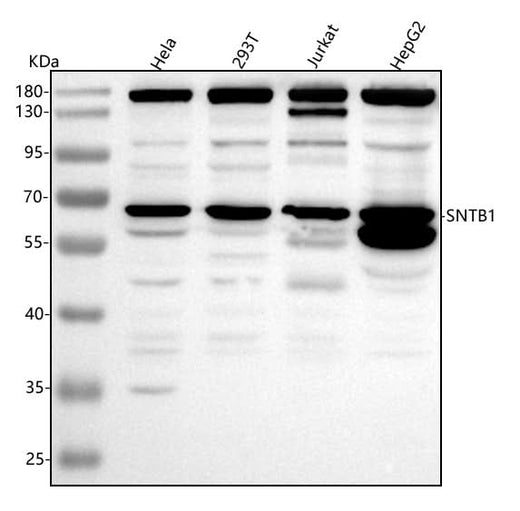 Anti-SNTB1 Antibody Picoband® Boster Bio