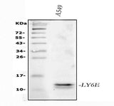 Anti-LY6E/SCA-2 Antibody Picoband® Boster Bio