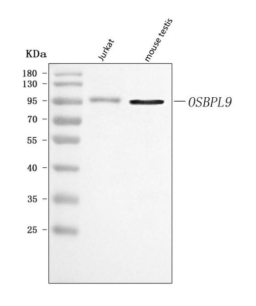 Anti-OSBPL9 Antibody Picoband® Boster Bio