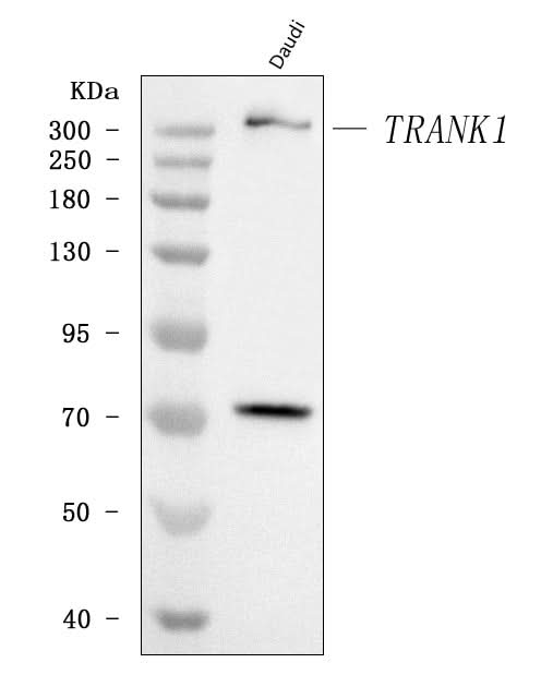 Anti-TRANK1 Antibody Picoband® Boster Bio