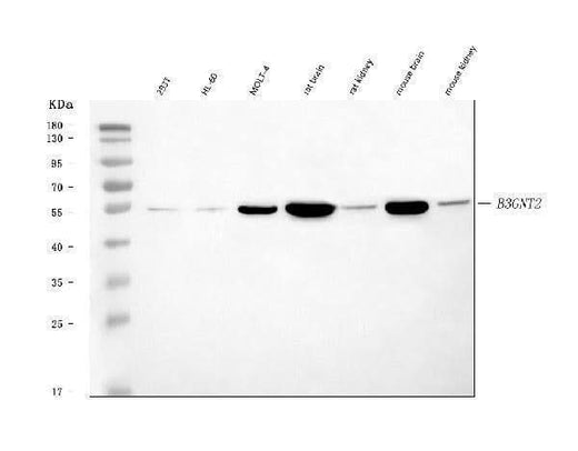 Anti-B3GNT2 Antibody Picoband® Boster Bio