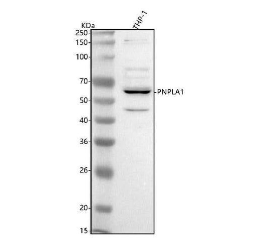 Anti-PNPLA1 Antibody Picoband® Boster Bio