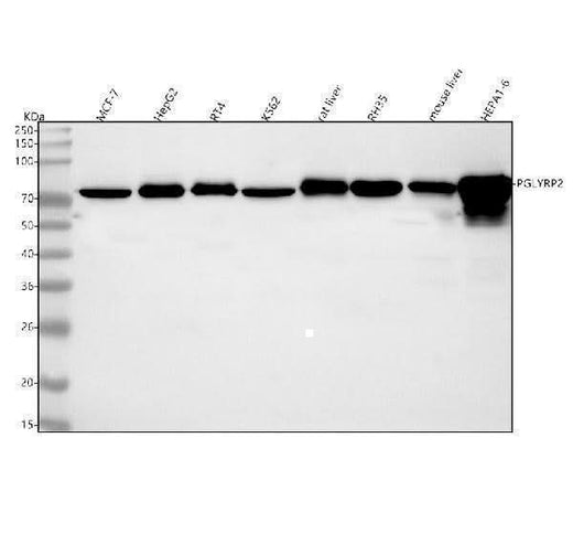 Anti-PGLYRP2 Antibody Picoband® Boster Bio