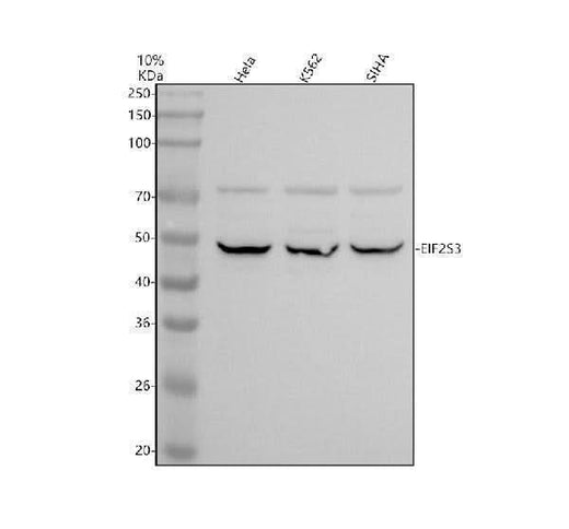 Anti-EML1 Antibody Picoband® Boster Bio