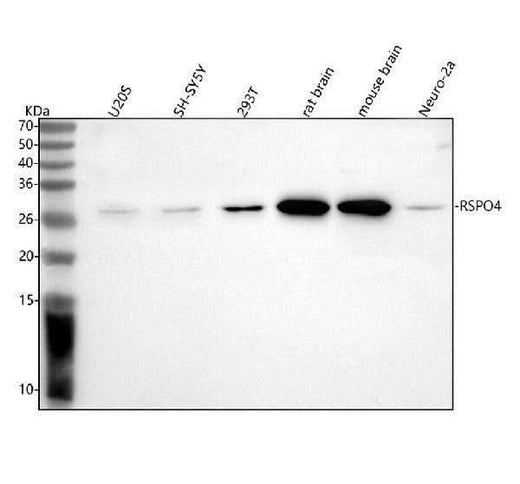 Anti-RSPO4 Antibody Picoband® Boster Bio