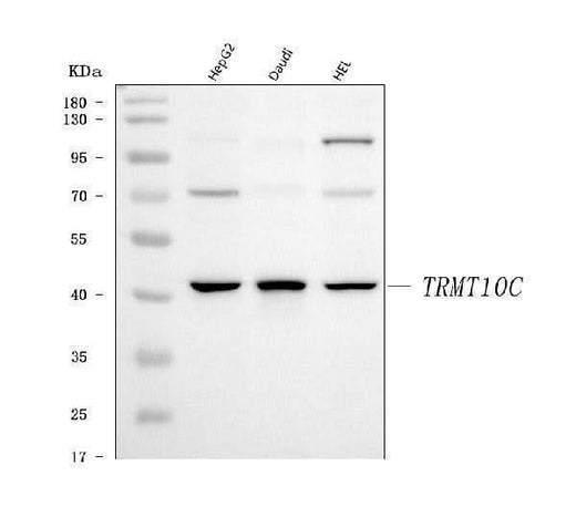 Anti-TRMT10C Antibody Picoband® Boster Bio