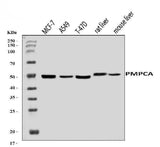 Anti-PMPCA/INPP5 Antibody Picoband® Boster Bio