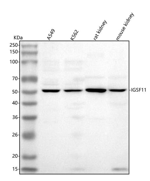 Anti-IGSF11 Antibody Picoband® Boster Bio