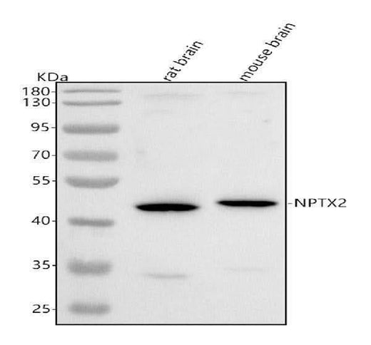 Anti-NPTX2 Antibody Picoband® Boster Bio