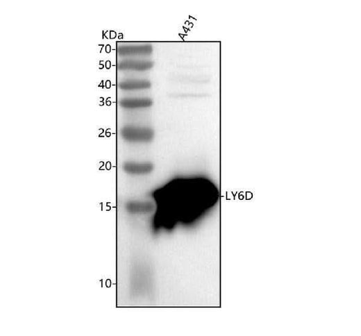 Anti-LY6D Antibody Picoband® Boster Bio