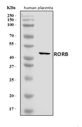 Anti-ROR beta/RORB Antibody Picoband® Boster Bio