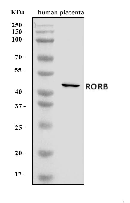 Anti-ROR beta/RORB Antibody Picoband® Boster Bio