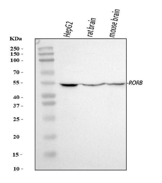 Anti-ROR beta/RORB Antibody Picoband® Boster Bio