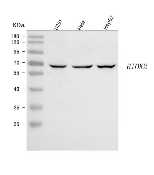 Anti-RIOK2 Antibody Picoband® Boster Bio