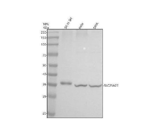 Anti-SLC25A27 Antibody Picoband® Boster Bio