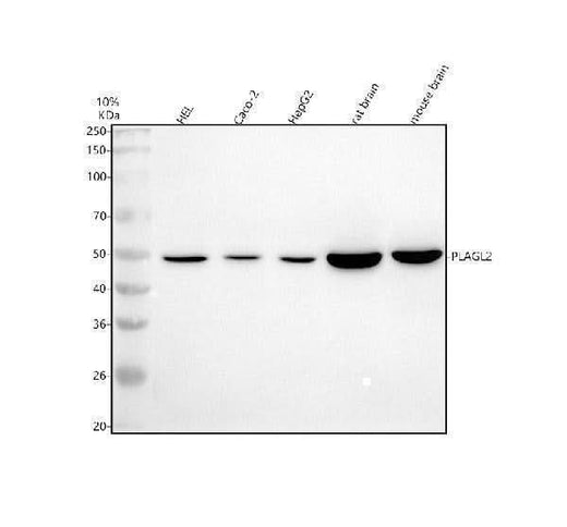 Anti-PLAGL2 Antibody Picoband® Boster Bio