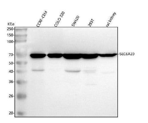 Anti-SLC6A20 Antibody Picoband® Boster Bio