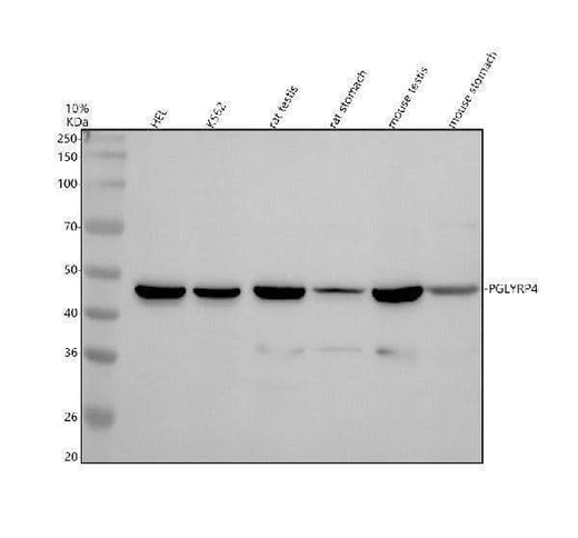 Anti-PGLYRP4 Antibody Picoband® Boster Bio