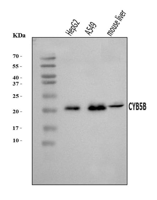Anti-CYB5B Antibody Picoband® Boster Bio