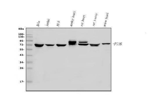 Anti-PI-16/PI16 Antibody Picoband® Boster Bio