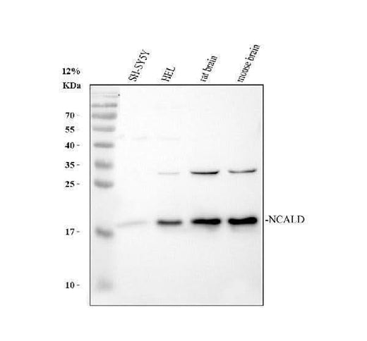 Anti-NCALD Antibody Picoband® Boster Bio