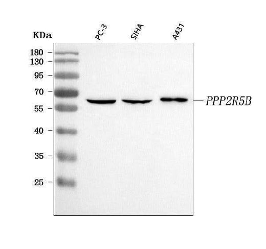 Anti-PPP2R5B Antibody Picoband® Boster Bio