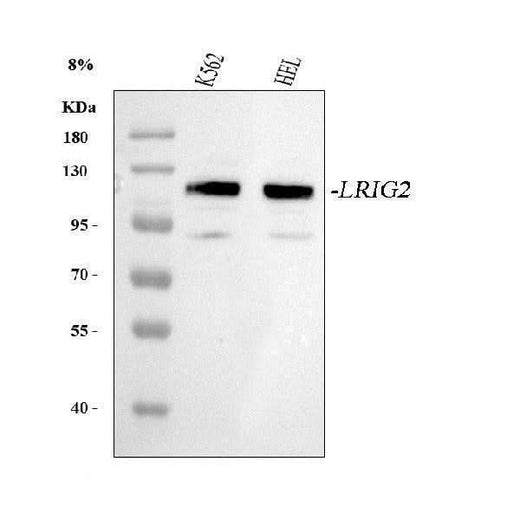 Anti-LRIG2 Antibody Picoband® Boster Bio