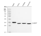 Anti-QPRT Antibody Picoband® Boster Bio