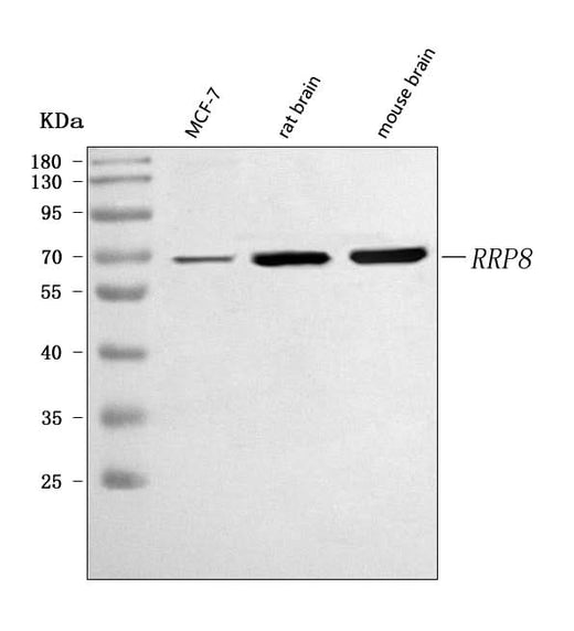 Anti-RRP8 Antibody Picoband® Boster Bio