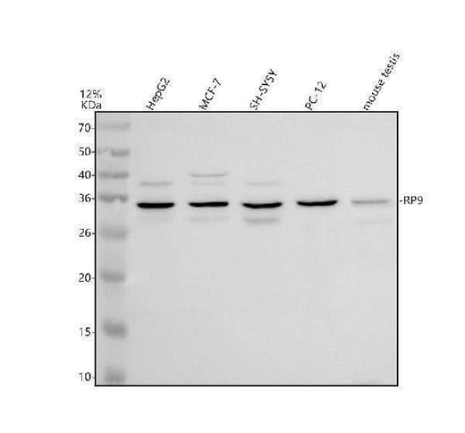 Anti-RP9 Antibody Picoband® Boster Bio