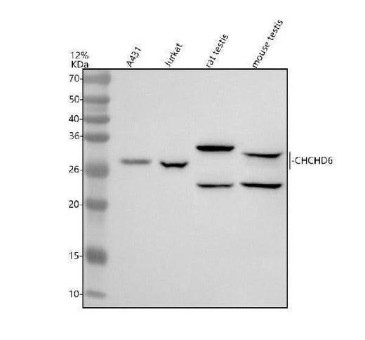 Anti-ENPP6 Antibody Picoband® Boster Bio