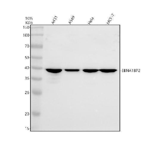 Anti-ENPP7 Antibody Picoband® Boster Bio