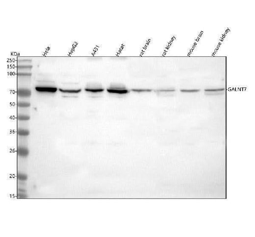 Anti-GALNT7 Antibody Picoband® Boster Bio