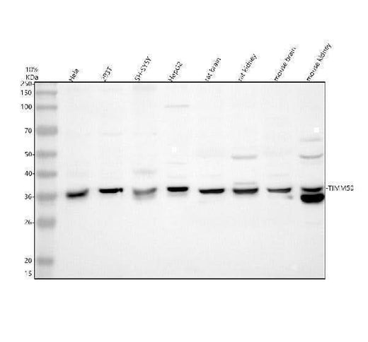 Anti-TIMM50 Antibody Picoband® Boster Bio