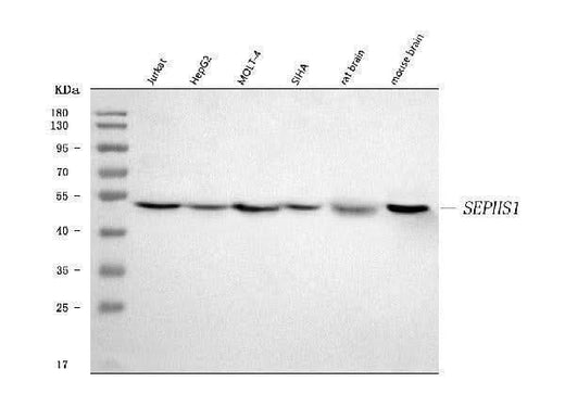 Anti-Selenophosphate synthetase 1/SEPHS1 Antibody Picoband® Boster Bio