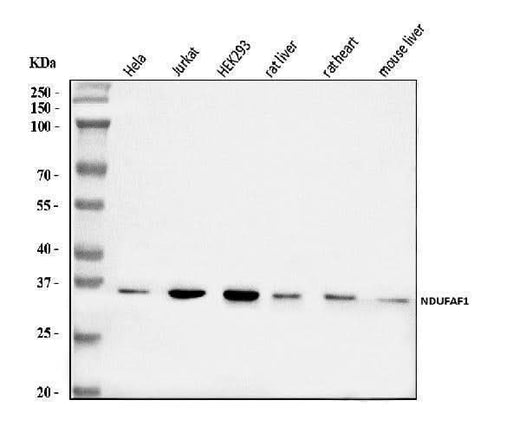 Anti-NDUFAF1 Antibody Picoband® Boster Bio