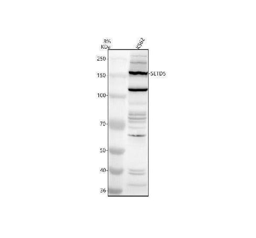 Anti-SETD5 Antibody Picoband® Boster Bio