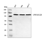 Anti-PPP1R15B Antibody Picoband® Boster Bio