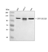 Anti-PPP1R15B Antibody Picoband® Boster Bio