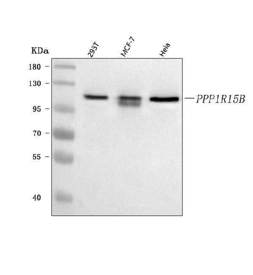 Anti-PPP1R15B Antibody Picoband® Boster Bio