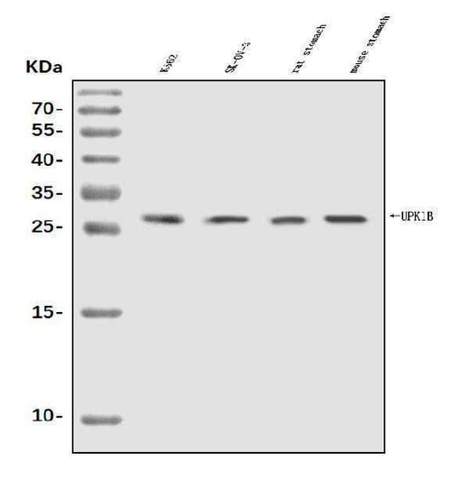 Anti-Uroplakin Ib/UPIb Antibody Picoband® Boster Bio