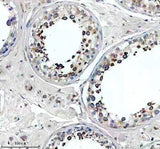 Anti-SLC2A11 Antibody Boster Bio