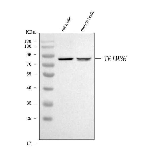 Anti-TRIM36 Antibody Picoband® Boster Bio