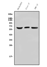 Anti-ARSE/ASE/ARSL Antibody Picoband® Boster Bio