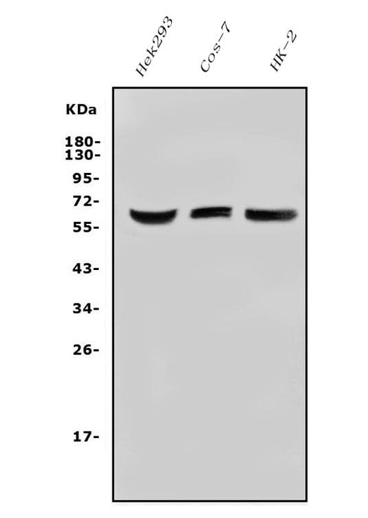 Anti-ARSE/ASE/ARSL Antibody Picoband® Boster Bio
