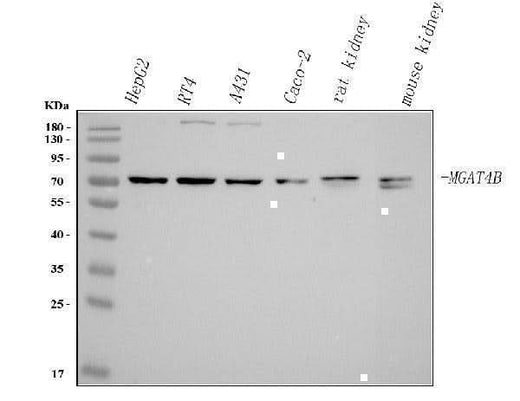 Anti-MGAT4B Antibody Picoband® Boster Bio