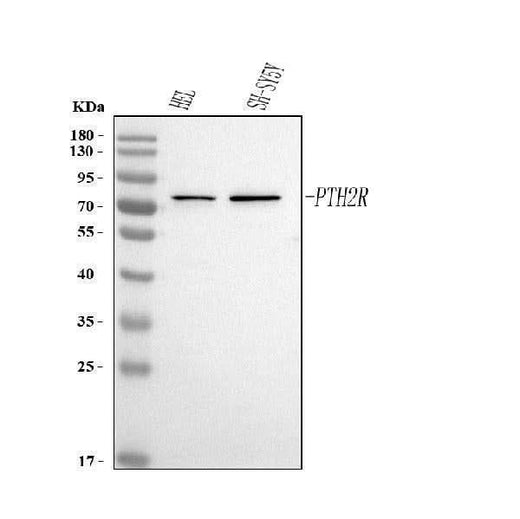 Anti-PTH2R Antibody Picoband® Boster Bio