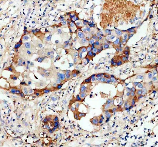 Anti-GJD3 Antibody Boster Bio