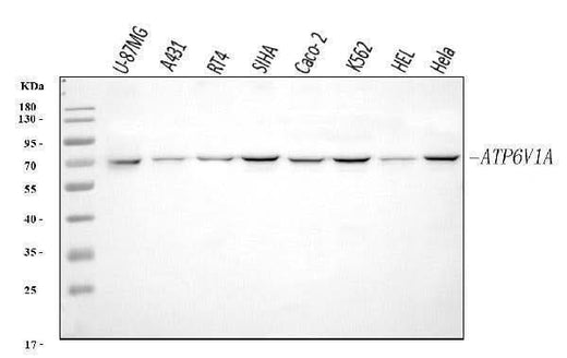 Anti-ATP6V1A Antibody Picoband® Boster Bio