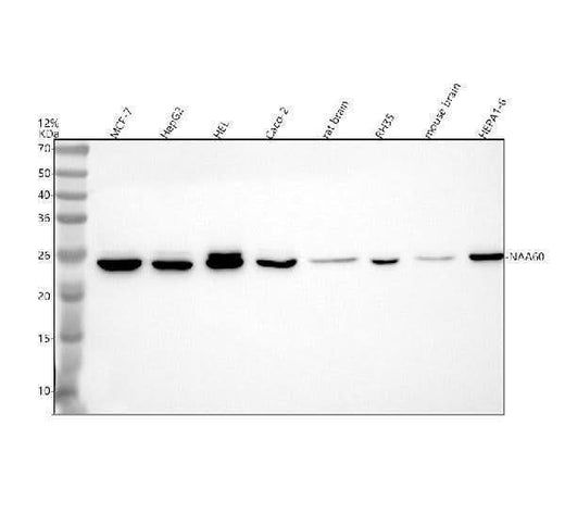 Anti-NAA60 Antibody Picoband® Boster Bio